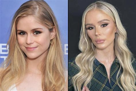 erin moriaty plastic surgery|Why The Boys Erin Moriarty Quit Instagram